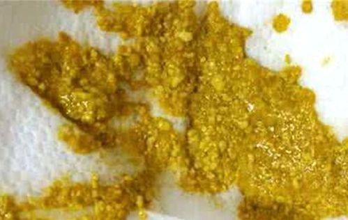 大便扁平图片,揭秘健康信号与应对策略