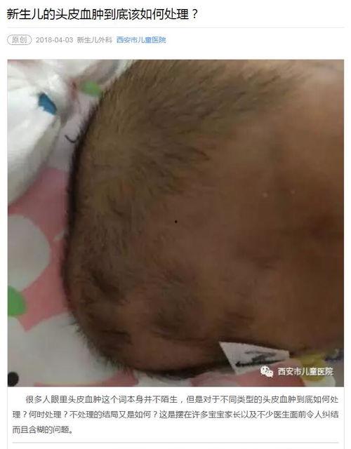 头皮血肿图片,形态与成因解析