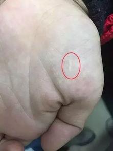 割手掌心的图片大全,揭秘割伤背后的心理与情感