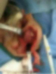 吃人图片大全大图,吃人图片大全大图背后的恐怖真相